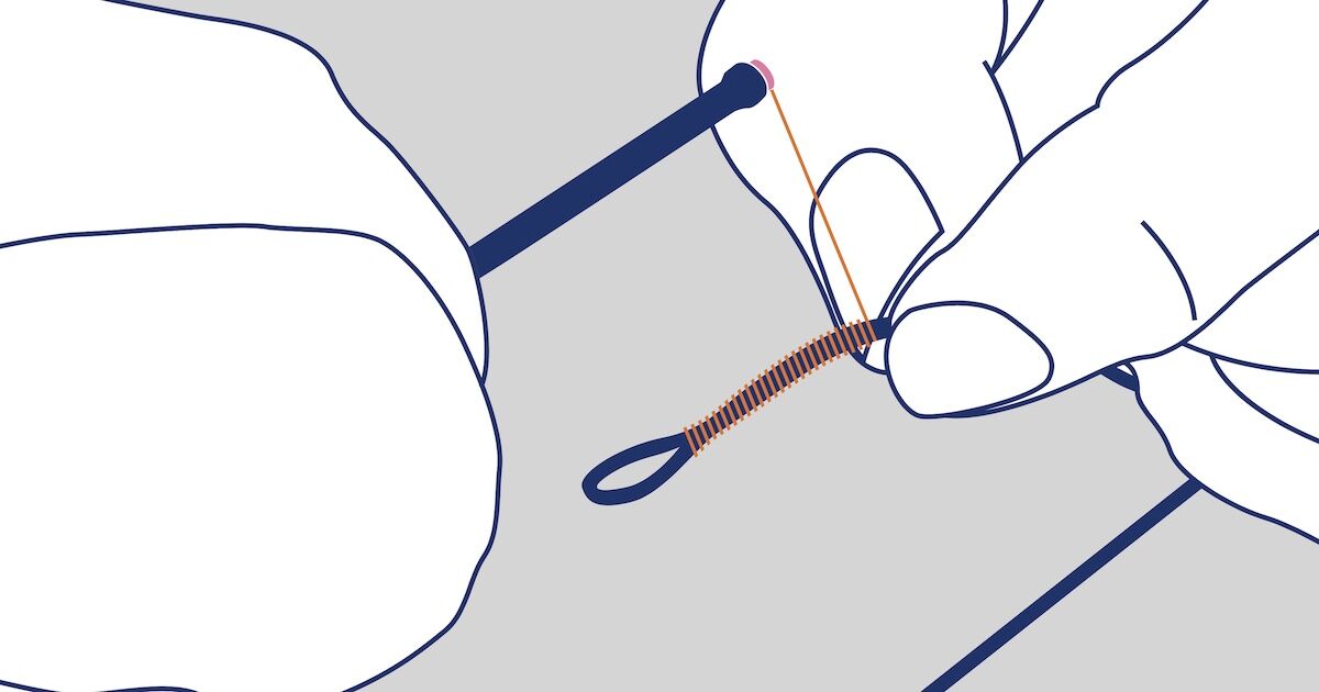 IFM Knots